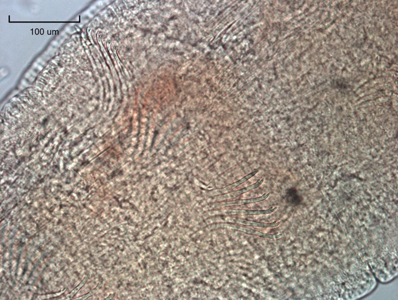photomicrograph of part of a freshwater oligochaete worm showing two bundles of chaetae with 6 chaetae with the upper tooth longer than the lower tooth
