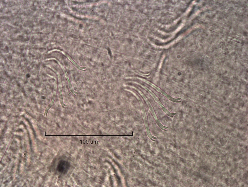 photomicrograph of part of a freshwater oligochaete worm showing two bundles of chaetae with 4 chaetae with the upper tooth about as long as the lower tooth. Some upper teeth are worn or broken.