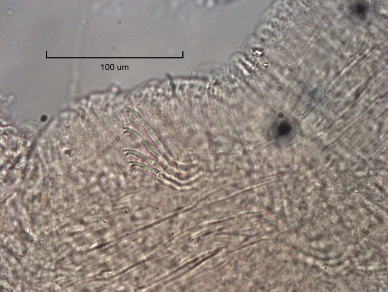 photomicrograph of part of a freshwater oligochaete worm showing a bundle of chaetae with 4 chaetae with the upper tooth about as long as the lower tooth.