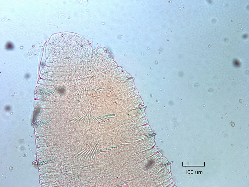 Photomicrograph of the head of an oligochaete worm with bifid crochet chaetae and no hairs.