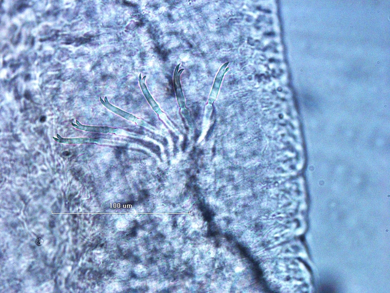 Photomicrograph of a bundle of somatic hairs (chaetae) of an oligochaete worm. The ends are bifid, with the upper tooth slightly longer than the lower.