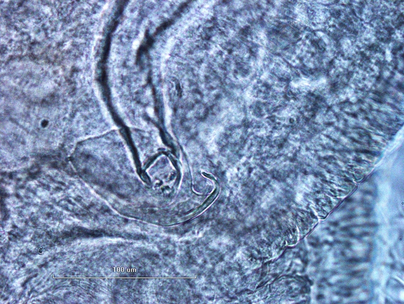 Photomicrograph of the reproductive structure of an oligochaete worm. The head plate of a penis sheath is broadly triangular, with the top point curved and dangling to the side.