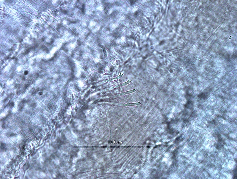 Photomicrograph of a bundle of somatic hairs (chaetae) of an oligochaete worm. The ends are bifid, with the upper tooth slightly thinner than the lower.