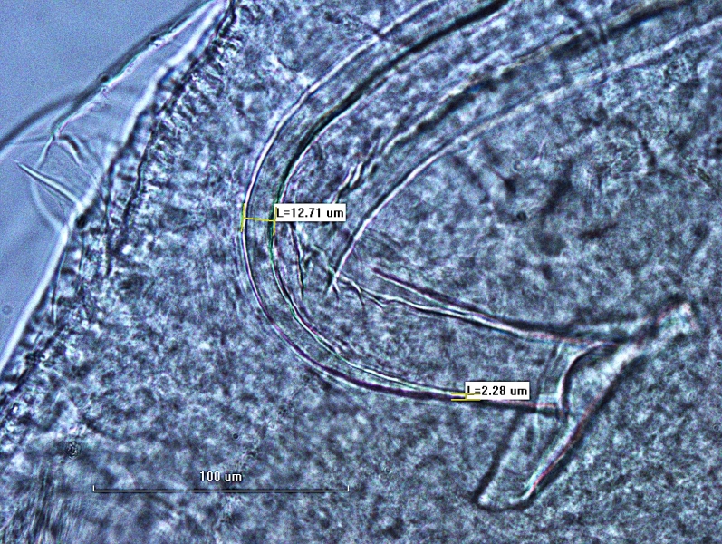 Photomicrograph of the reproductive structure of an oligochaete worm. The  shaft of the penis sheath is curved at a sharp angle before the head plate. The wall of the shaft is quite thick but it thins just before the head plate. Thick is 12.71 μm and thin is 2.28 μm.