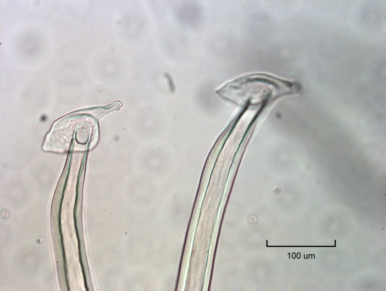 photomicrograph of the reproductive structures of a freshwater oligochaete worm outside of the body. The penis sheaths have very thick walls that thin right before the headplate, which has a pointed tip leaning to one side and an uneven plate with a wide lobe on the opposite side from the tip