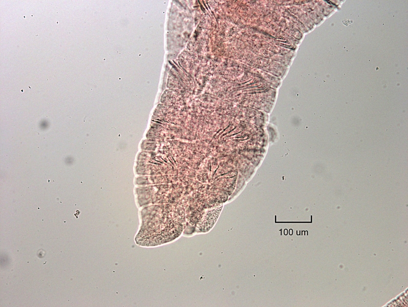 Photomicrograph of the head of an oligochaete worm with bifid crochet chaetae and no hairs