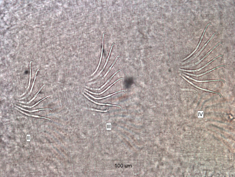 photomicrograph of part of a freshwater oligochaete showing three bundles of chaetae in segments labeled II, III, and IV. There are 6-8 chaetae per bundle and the upper tooth is a little shorter than the lower tooth, or broken.