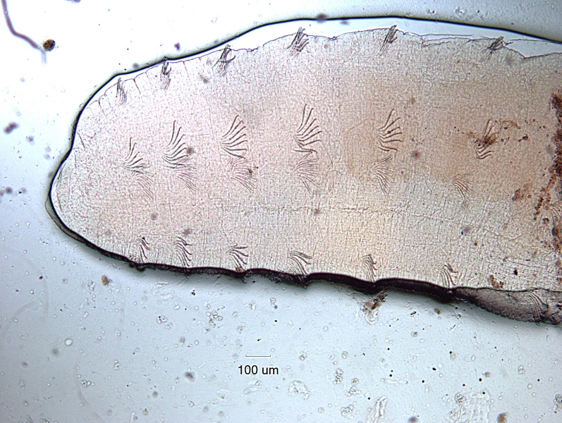 Photomicrograph of the head of an oligochaete worm with bifid chaetae and no hair chaetae. There is an outline around the worm because the mounting media only covered the worm and not the entire slide.