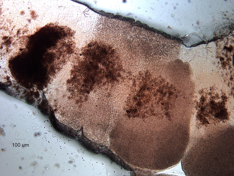 Photomicrograph of the reproductive area of an oligochaete worm. The skin is thickened with darker papillae. There are two long cylindrical penis sheaths partially visible through the darker skin.