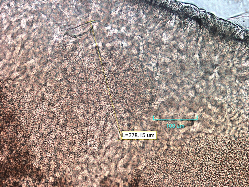 Photomicrograph of the reproductive structure of a worm. There is a penis sheath that is longer than it is wide with a flat round end. It measures 278.15 µm