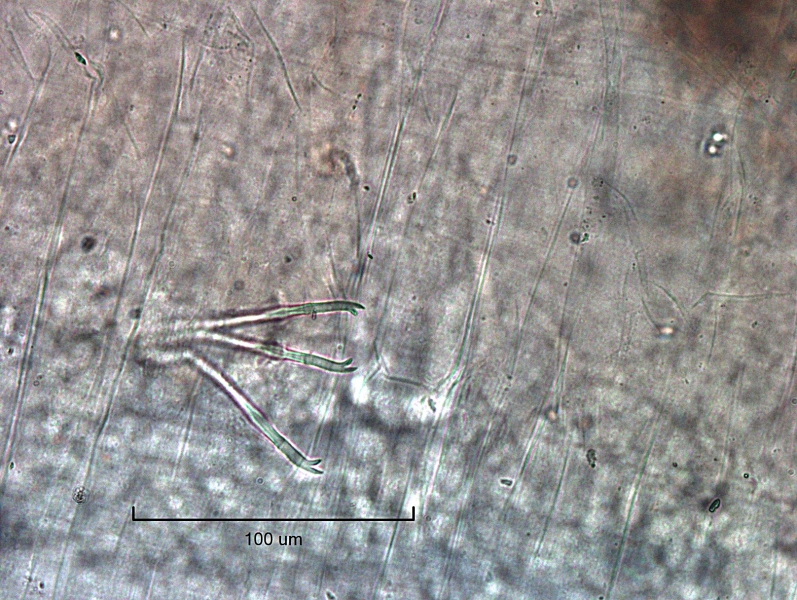Photomicrograph of a bundle of somatic hairs (chaetae) of an oligochaete worm. The three chaetae have bifid ends, and the upper tooth is slightly longer than the lower.