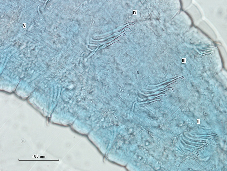 Photomicrograph of part of a worm showing the chaetae of several segments. The chaetae are bent up to 90° with the upper tooth more than twice as long as the very short lower tooth. Bundles are labelled II, III, IV, and V.