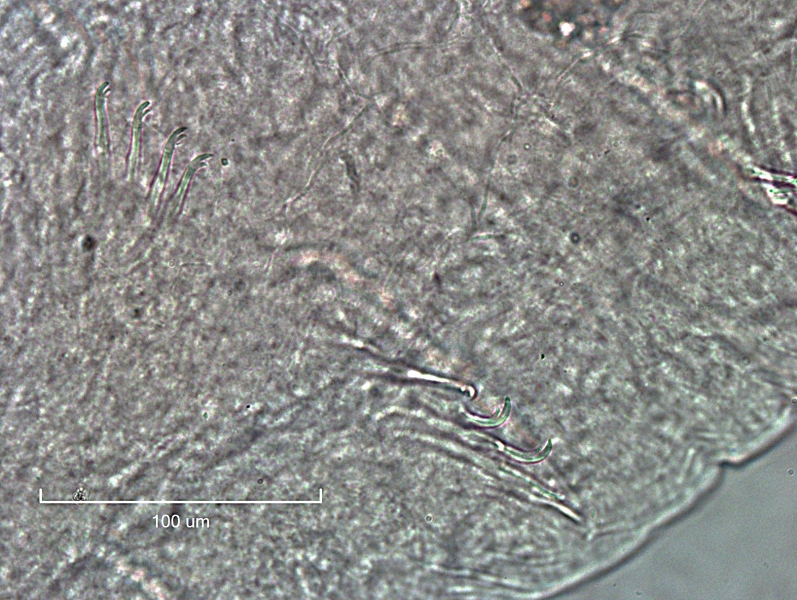 Photomicrograph of the somatic hairs (chaetae) of an oligochaete worm. There are two bundles of bifid chaetae. One has the upper tooth longer than the lower. The other has larger chaetae with the upper tooth much longer and thicker than the lower, curved at 90° to the shaft of the chaetae.