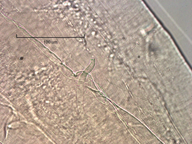 photomicrograph of part of a freshwater oligochaete worm showing a single chaetae in the body. It is fairly thick with the upper tooth shorter than the lower tooth.