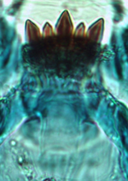 Photomicrograph of part of a chironomid midge mouthpart showing a ligula with five teeth, with the outer and middle teeth longer than the second and fourth tooth.