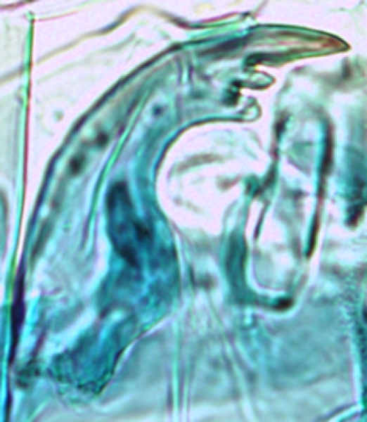 Photomicrograph of part of a chironomid midge mouthpart showing a mandible with three mandibular teeth, the inner teeth are smaller than the first tooth but well developed, and the bottom one is bulbous.