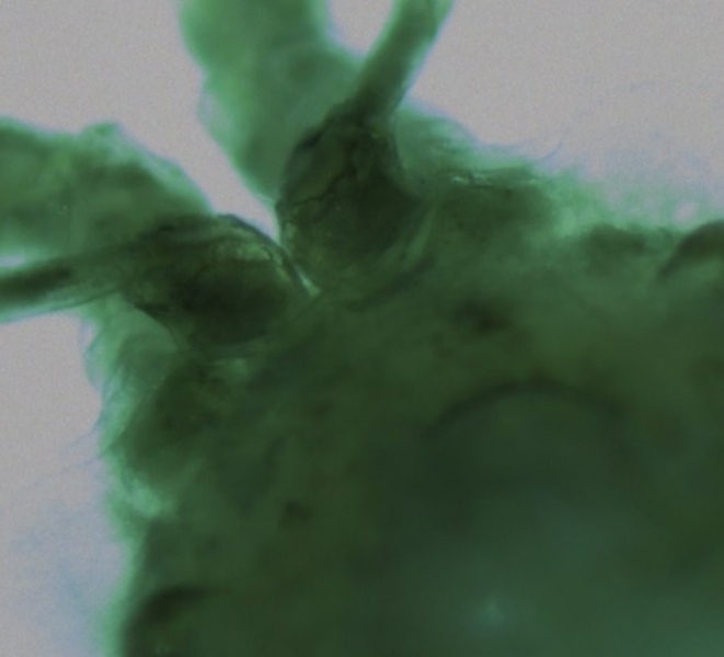 Photomicrograph of top view of the head of a crustacean, with ridges at the base of the antennae.
