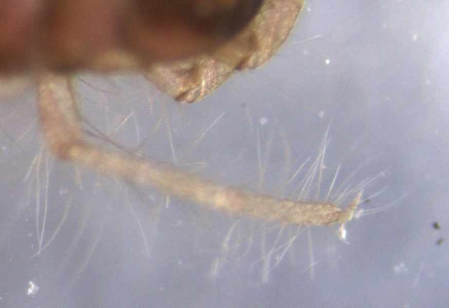 photomicrograph of the leg of an insect larvae
