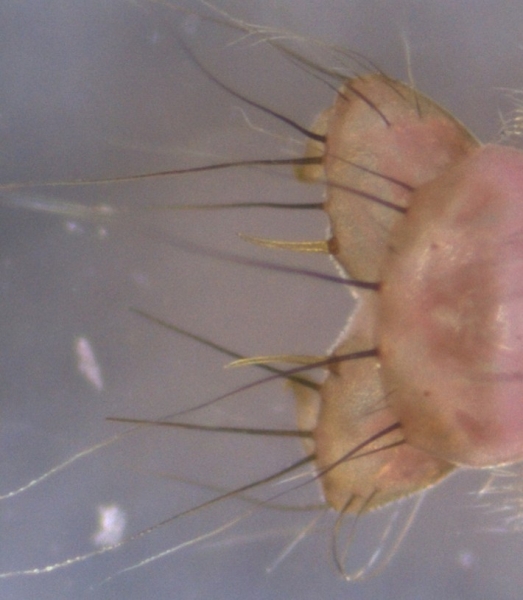 photomicrograph of the posterior end of an insect larvae showing the prolegs with one spur on each, and several hairs.