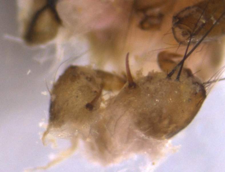 photomicrograph of a crumpled exoskeleton of an insect larva showing the posterior end with spurs sticking out of the prolegs