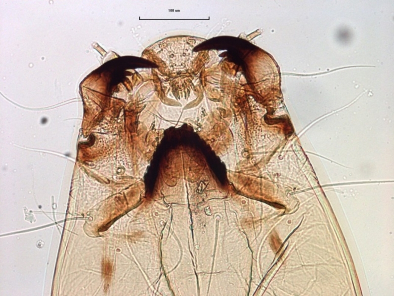photomicrograph of the head capsule of a chironomid midge larva showing the mandibles, premandibles, mentum, large ventromental plates, and antennae