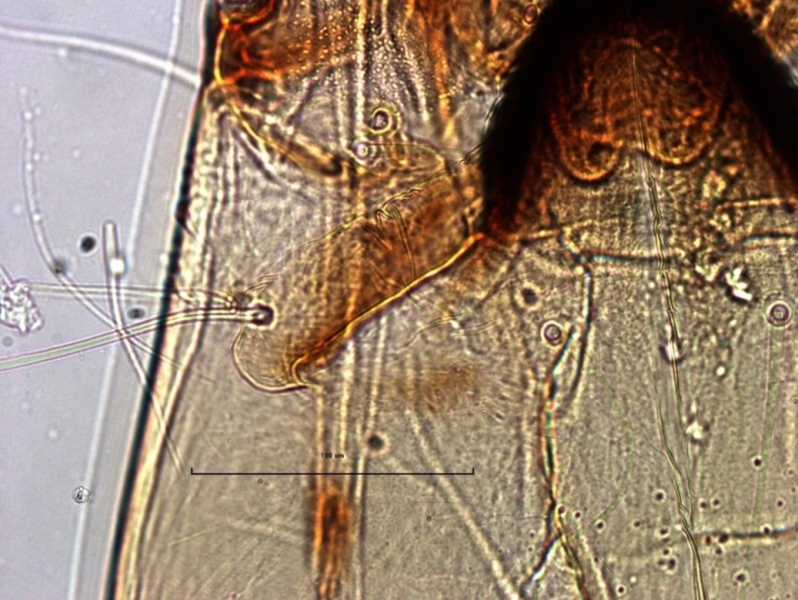 photomicrograph of part of the head capsule of a chironomid midge larvae showing a large ventromental plate