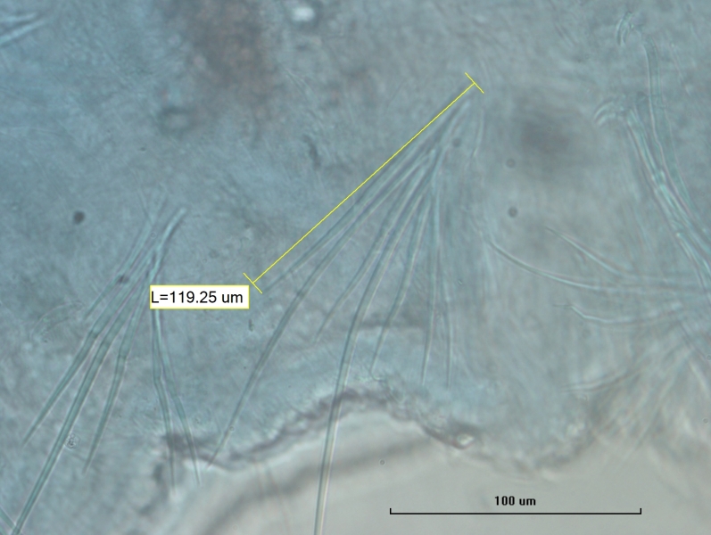 Photomicrograph of oligochaete worm features showing part of the body wall and many somatic hairs called chaetae. Each bundle of chaetae has several long hair chaetae and several shorter needle chaetae. One needle chaetae is measured L=119.25um. Scale 100um.