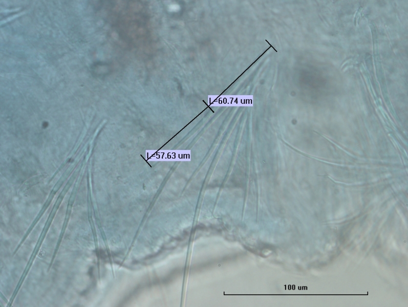 Photomicrograph of a freshwater oligochaete worm showing part of the body wall and many chaetae. Each bundle of chaetae has several long hair chaetae and several shorter needle chaetae. One needle chaetae is measured in two sections L=57.63um and L=60.74um. Scale 100um.