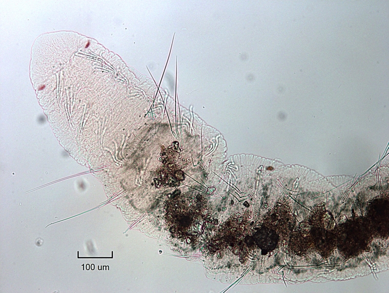 photomicrograph of a freshwater oligochaete worm. It has eyes and long hairs that start back farther (in VI) than the ventral chaetae start (in II)