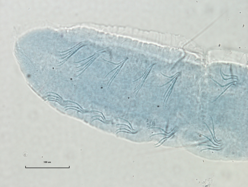 Photomicrograph of the head of an oligochaete worm showing two faint eyespots and two rows of bundles of somatic hairs (chaetae).