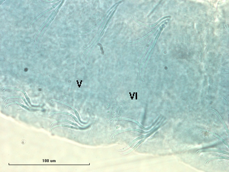 Photomicrograph of oligochaete worm features showing part of the body wall and many somatic hairs called chaetae. There are bundles of several chaetae in two rows. The chaetae remain the same in V and VI, bifid (two teeth) with thin upper teeth and thick lower teeth.