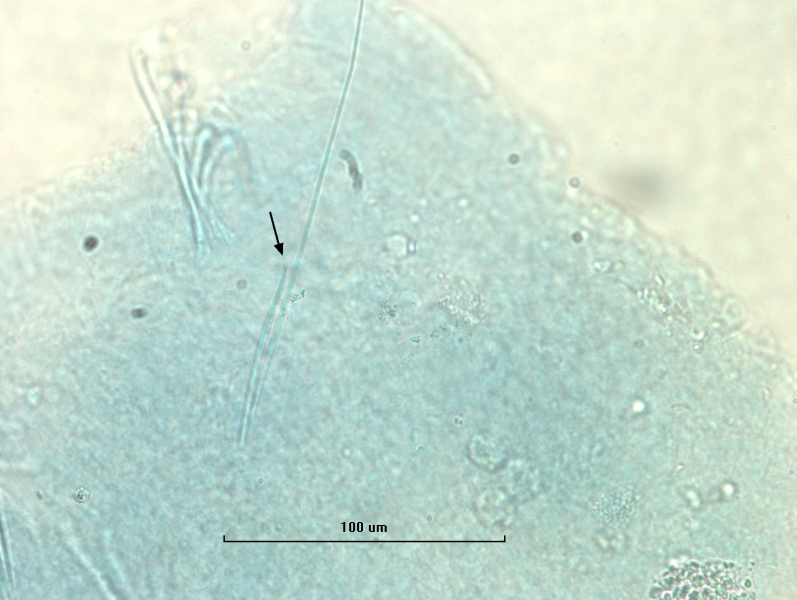 Photomicrograph of oligochaete worm features showing part of the body wall, a long hair chaetae, and an arrow pointing to a needle chaetae with two divergent teeth. Scale bar 100um.