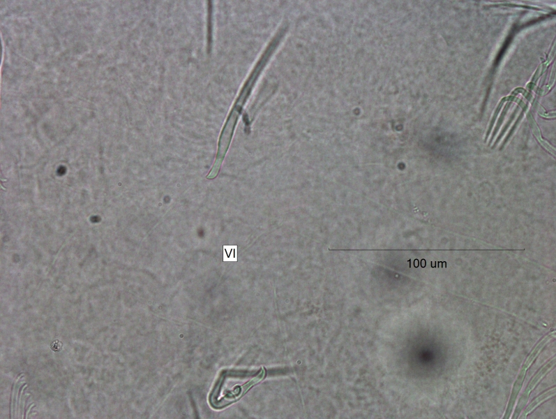 Photomicrograph of part of a freshwater oligochaete worm showing two thick chaetae in separate bundles that are simple-pointed with a slightly curved end in segment VI. Scale bar 100um.