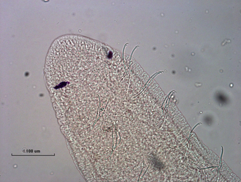 Photomicrograph of the head of an oligochaete worm showing two eyespots and two rows of bundles of somatic hairs (chaetae).