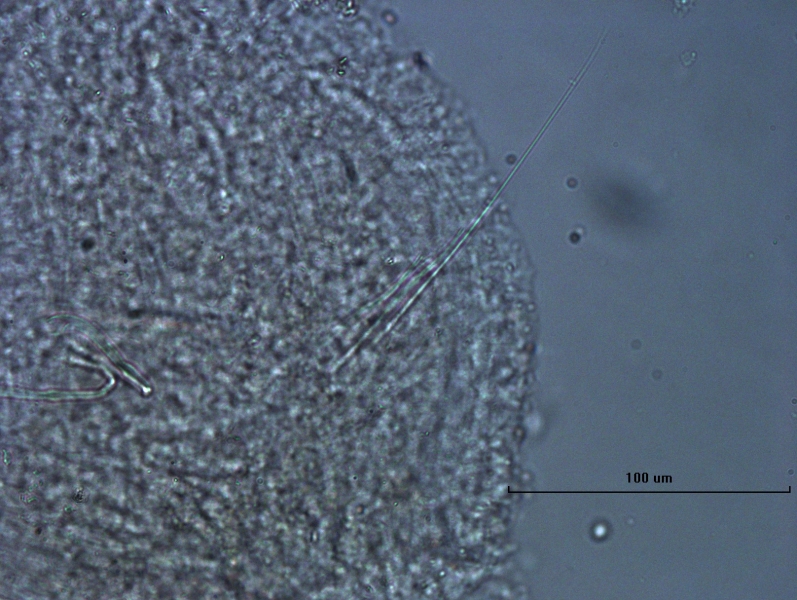 Photomicrograph of oligochaete worm features showing part of the body wall, a long hair chaetae, and two needle chaetae with two parallel teeth. Scale bar 100um.