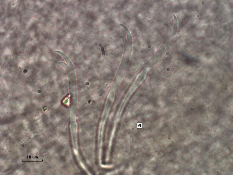 Photomicrograph of oligochaete worm features showing part of the body wall with a bundle of somatic hairs (chaetae) with a upper tooth twice as long as the lower tooth. Scale bar 10um.