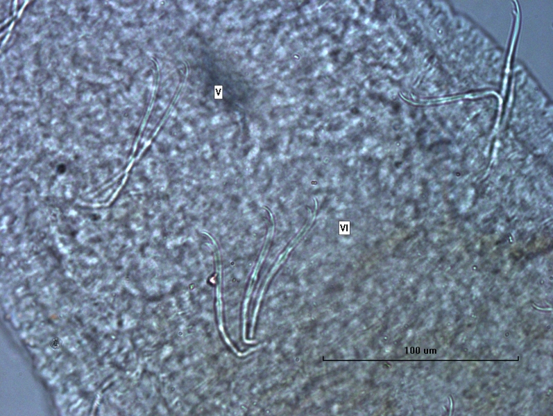 Photomicrograph of part of a freshwater oligochaete worm showing a bundle of thin chaetae with a upper tooth twice as long as the lower tooth in V and a bundle of thicker chaetae with the upper tooth twice as long as the lower in VI. Scale bar 10um.