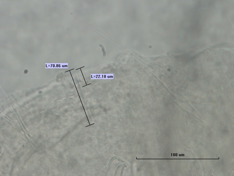 Photomicrograph of part of a freshwater oligochaete worm showing a few bundles of chaetae. Each bundle has a two long hair chaetae and two shorter needle chaetae. One needle chaetae measures 70.86 um and part of the same needle also measures 22.18 um. Scale 100 um.