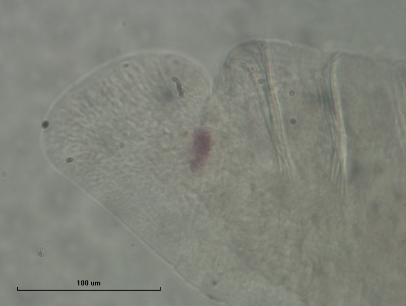 Photomicrograph of the head of an oligochaete worm showing two eyespots and two rows of bundles of somatic hairs (chaetae).