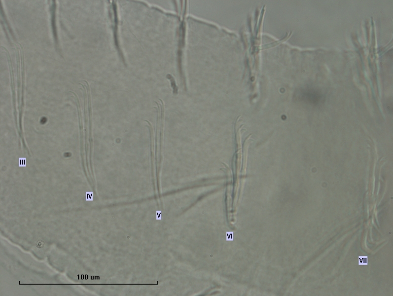 Photomicrograph of oligochaete worm features showing part of the body wall and many somatic hairs called chaetae. There are bundles of several chaetae in two rows. The chaetae switch from bifid (two teeth) with long, thin upper teeth, to having shorter, thin upper teeth.