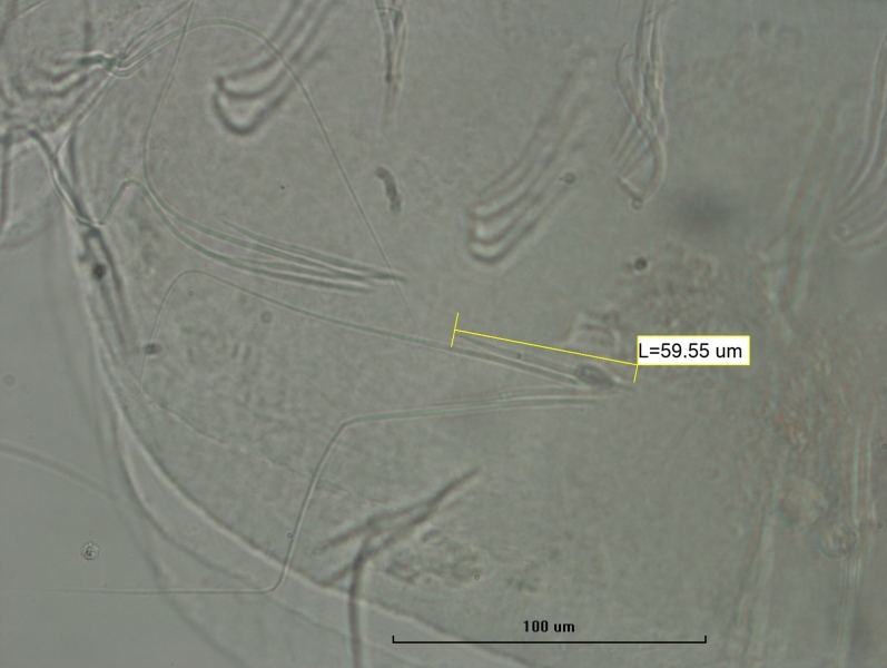 Photomicrograph of oligochaete worm features showing part of the body wall and many somatic hairs called chaetae. Each bundle of chaetae has a two long hair chaetae and two shorter needle chaetae. One needle chaetae measures 59.55um. Scale 100um.