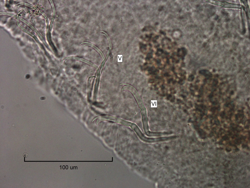 Photomicrograph of oligochaete worm features showing part of the body wall and many somatic hairs called chaetae. There are bundles of several chaetae in two rows. The chaetae switch from bifid (two teeth) with long, thin upper teeth, to having short, thin upper teeth.