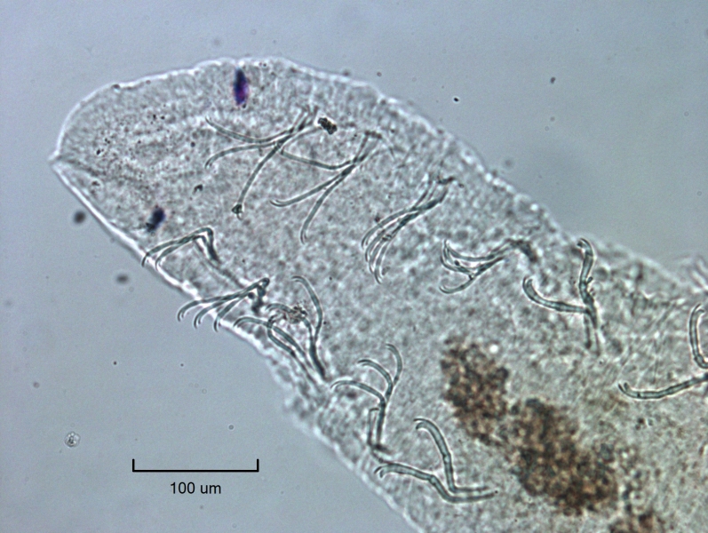 photomicrograph of the front end of a freshwater oligochaete worm showing the eyes and the underside of the worm and the bundles of chaetae there