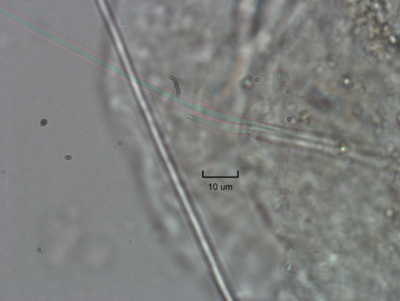 Photomicrograph of oligochaete worm features showing part of the body wall, a long hair chaetae, and a needle chaetae with two very short, parallel teeth. Scale bar 10um.