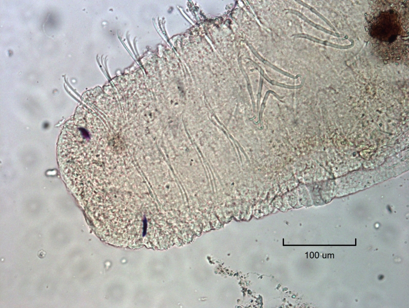 photomicrograph of a freshwater oligochaete worm in the process of asexual reproduction, a new worm with eyes and a square face