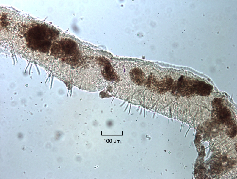 photomicrograph of a freshwater oligochaete worm in the process of asexual reproduction, with a new worm with eyes growing from the end of the first worm
