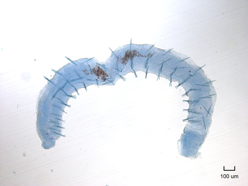 photomicrograph of a whole slide-mounted freshwater oligochaete worm with eyes. It has very thick straight solitary chaetae on its dorsal surface, making it look spiky. Scale bar 100 um.