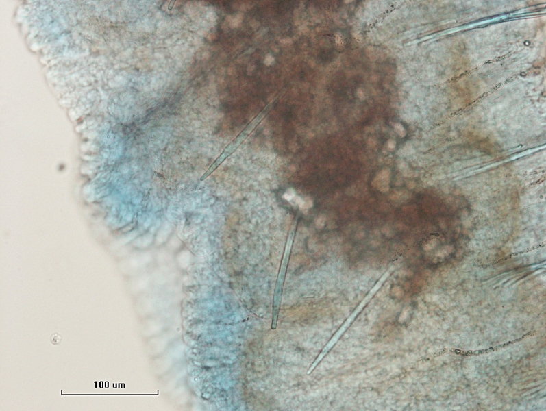 photomicrograph of part of a freshwater oligochaete worm. The dorsal chaetae are thick and straight with simple-pointed ends that are blunt or look slightly jagged. There is one chaetae per bundle. Scale bar 100 um.