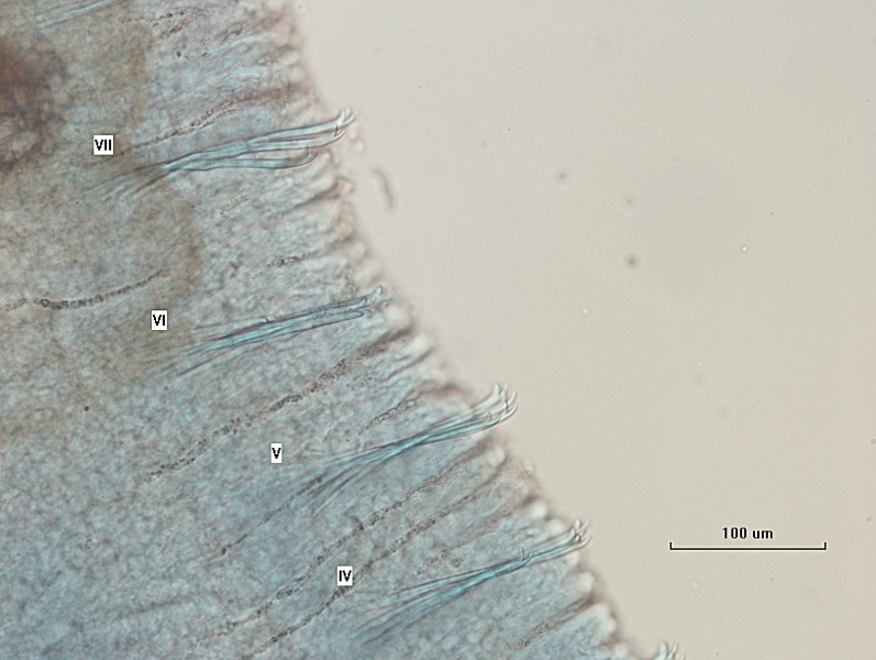 photomicrograph of part of a freshwater oligochaete worm. Segments labeled IV, V, VI, and VII with bundles of bifid chaetae. VI is shorter than V or VII, VII may be thicker than the previous bundles. The body wall is bumpy and some crevices are filled with grit. Scale bar 100 um.