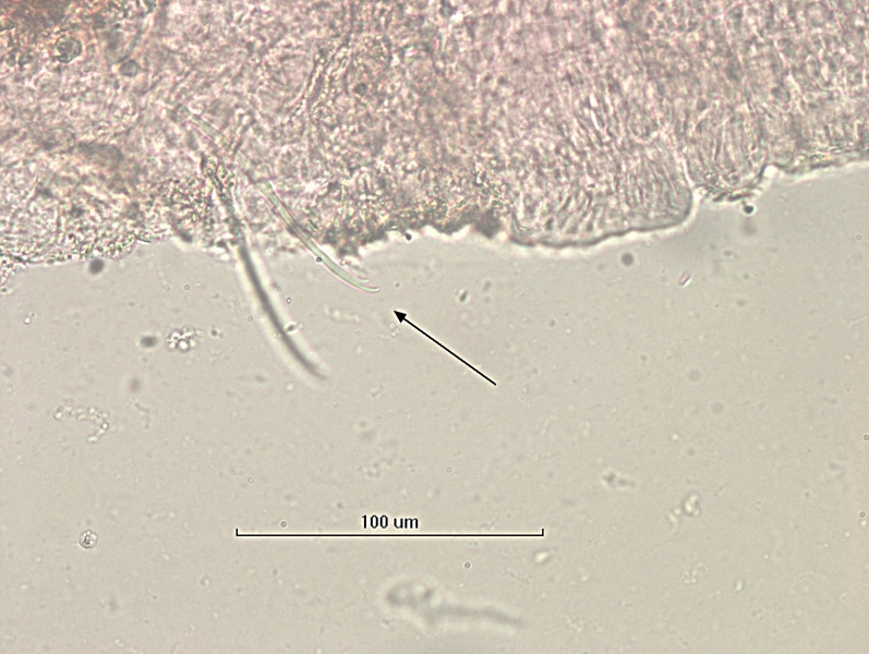 photomicrograph of part of a freshwater oligochaete worm showing a bifid chaetae with a long hooked upper tooth and a shorter, thicker lower tooth